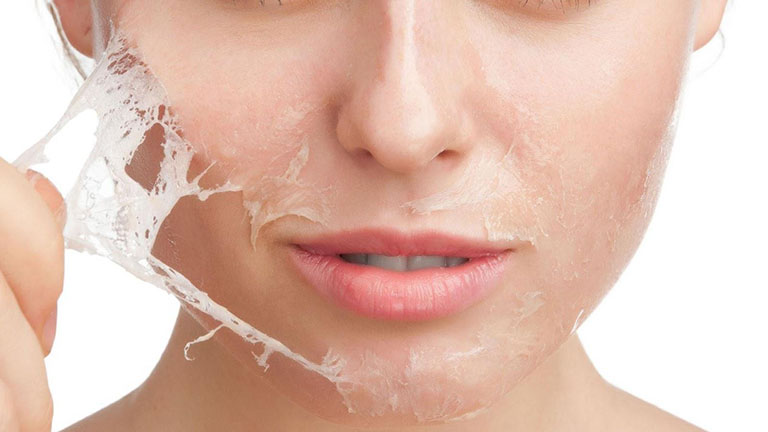 Làn da khô ráp, không đủ độ ẩm sẽ rất dễ bị bong tróc và mất đi khả năng kháng khuẩn của các tế bào da